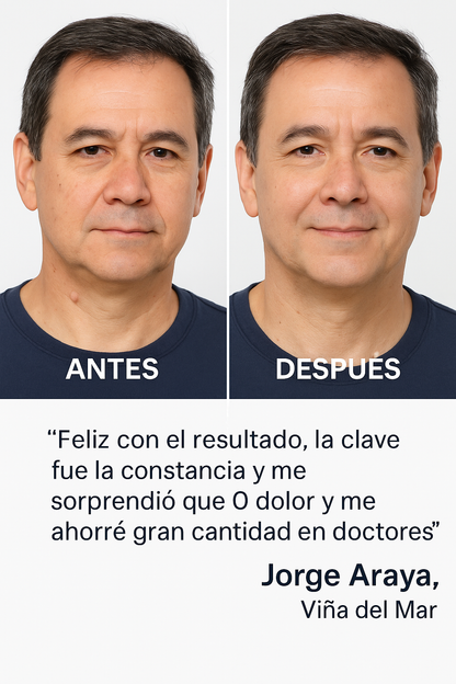 Parches Verrugas Premium ( Formula potenciada )