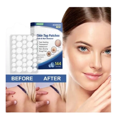 Parches Verrugas Premium ( Formula potenciada )